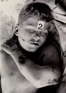 Unidentified victim< of massacre
at Doji Prekaz